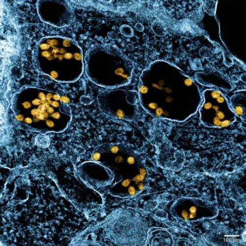 一个color-enhanced SHFV生长细胞培养的电子显微图。